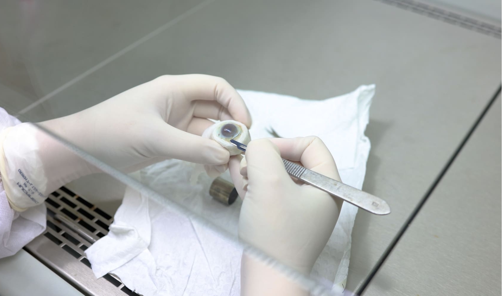 Banco de Olhos de Cascavel ultrapassa 7 mil doações em 20 anos e reforça a importância do gesto